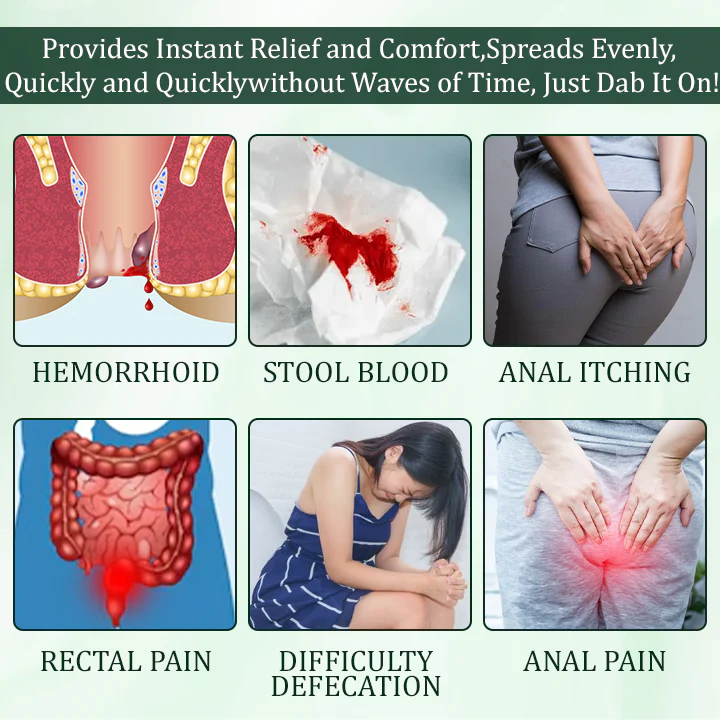 Fivfivgo™ Hemorrhoid Relief Ointment - Image 4