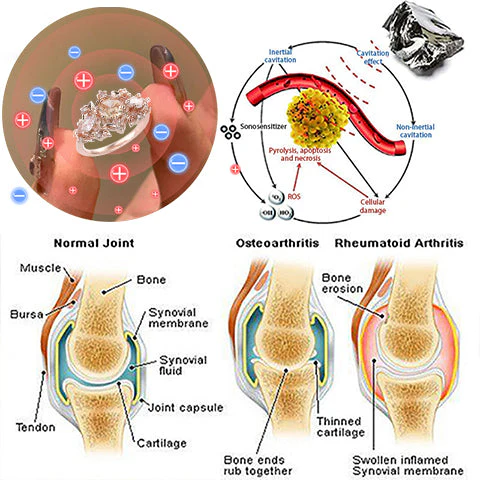 Диамантен пръстен с лимфна магнитна терапия DIYSTAR™ - Изображение 5