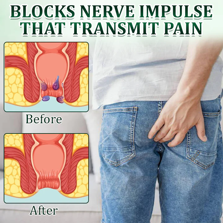 Fivfivgo™ Hemorrhoid Relief Ointment - Image 5