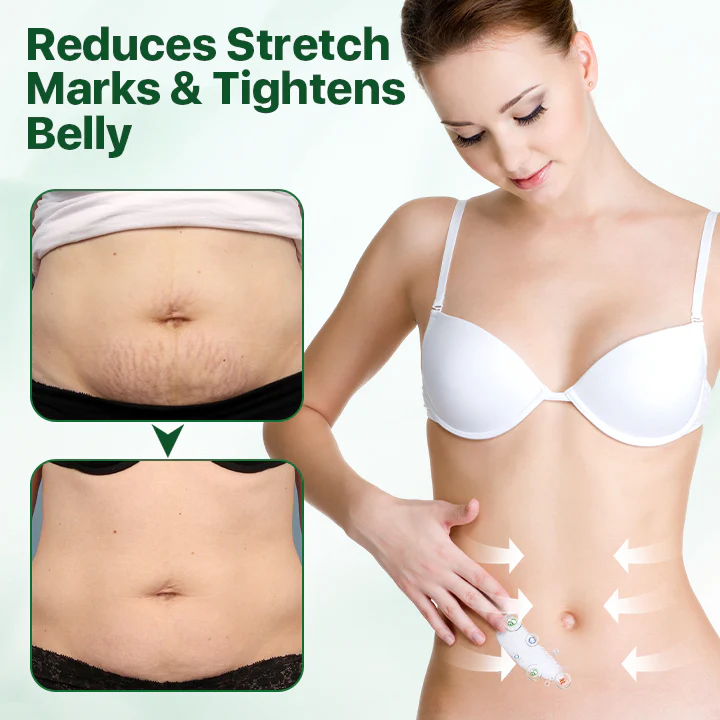 Biancat™ ሱፐር ኮላጅን እድሳት ክሬም - ምስል 3