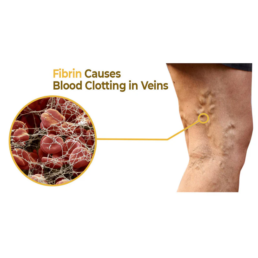 flysmus™ VaricoX Vein Dredge Bee Venom Spray - Image 4