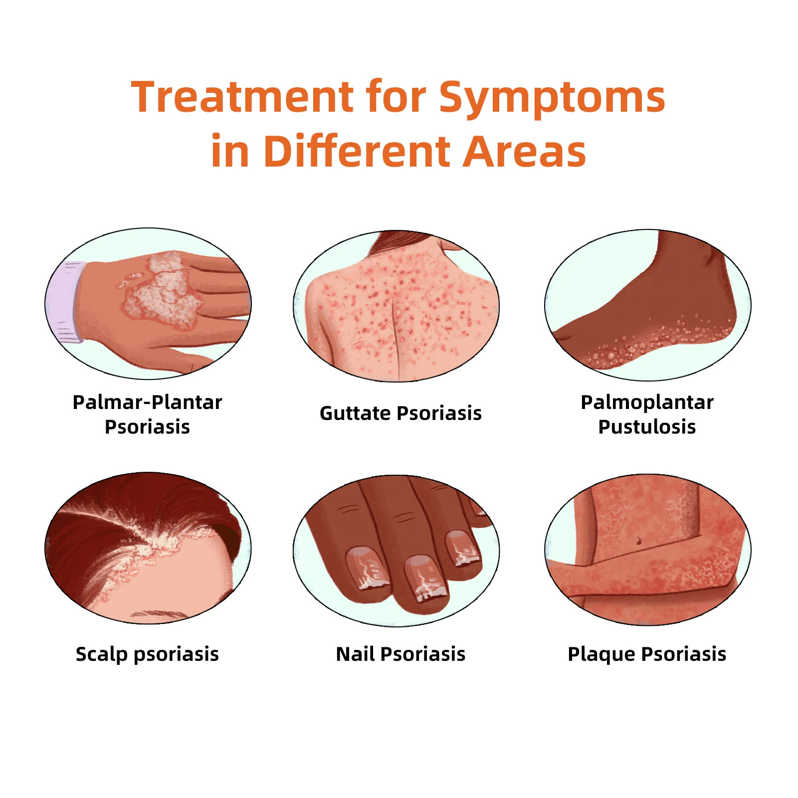 Крем за третиране на кожата Lovilds™ - Изображение 3