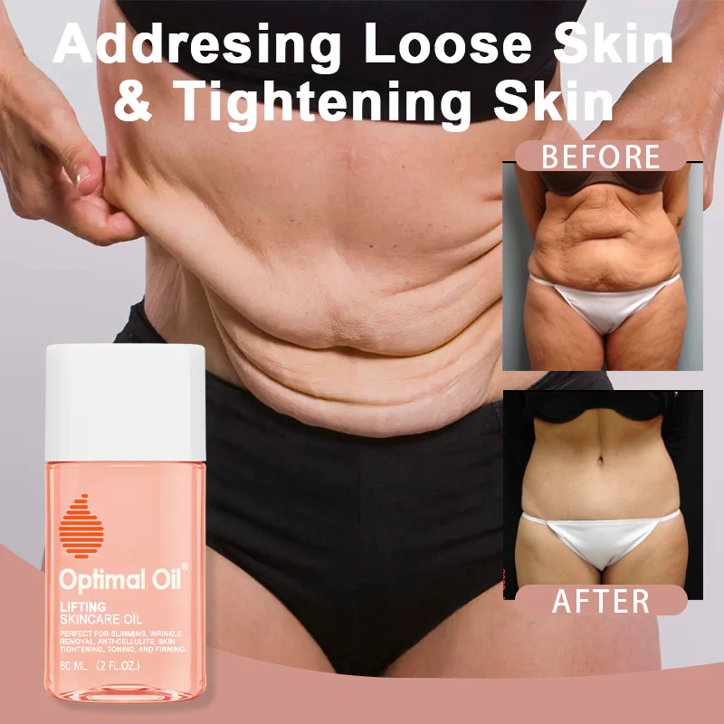 Optimal Oil®Collagen Boost Firming & Lifting Skincare Oil - Image 2
