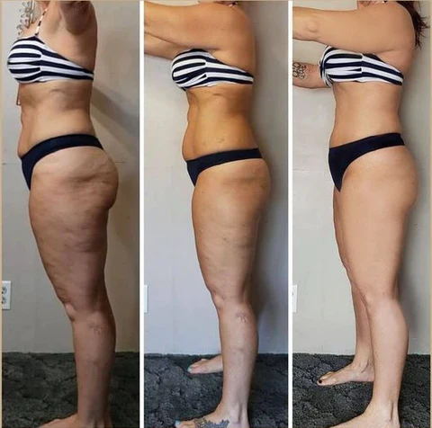 Optimal Oil®Collagen Boost Firming & Lifting Skincare Oil - Image 8