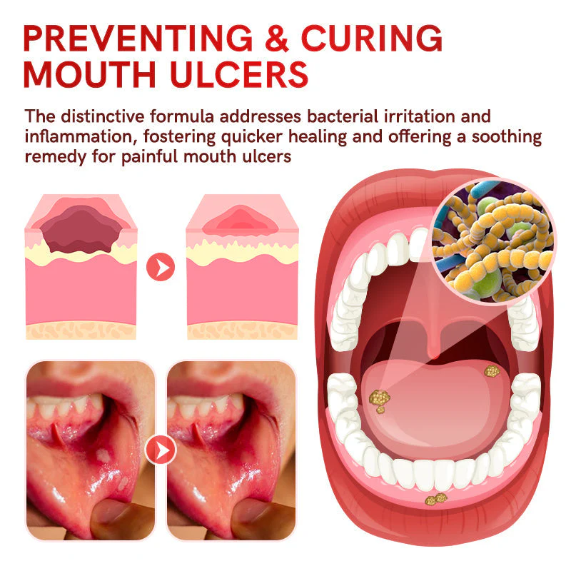 Furzero™ Aussie SP-6 пробиотична ултраизбелваща паста за зъби - Изображение 4
