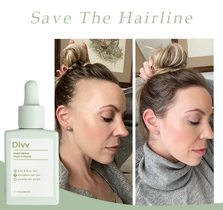 Divv™ Scalp Serum - Repair + Regrow Hair And Scalp - Image 3