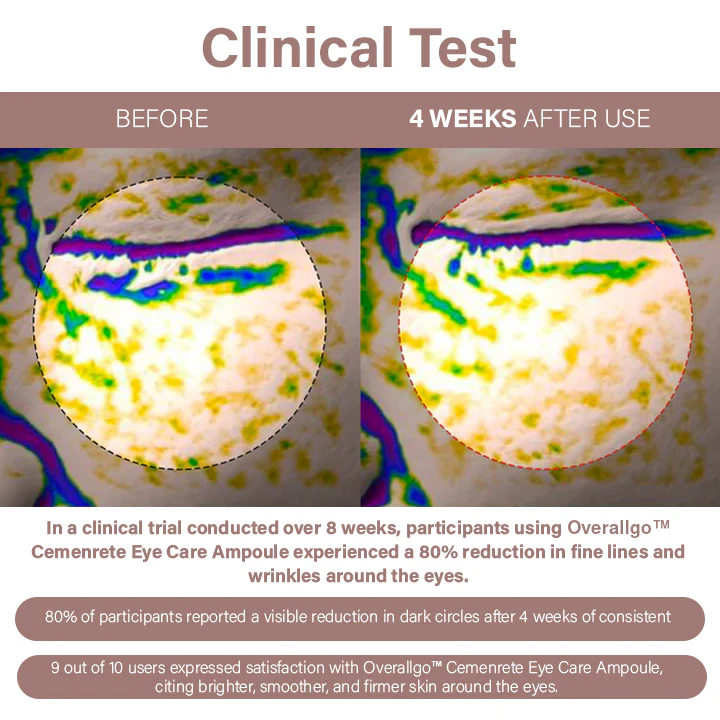 Oveallgo™ Cemenrete Eye Care Ampoule - Image 4