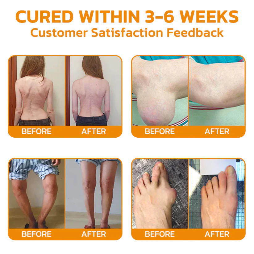 Fivfivgo™ крем за лечение на стави с пчелна отрова за потискане на болката - Изображение 4