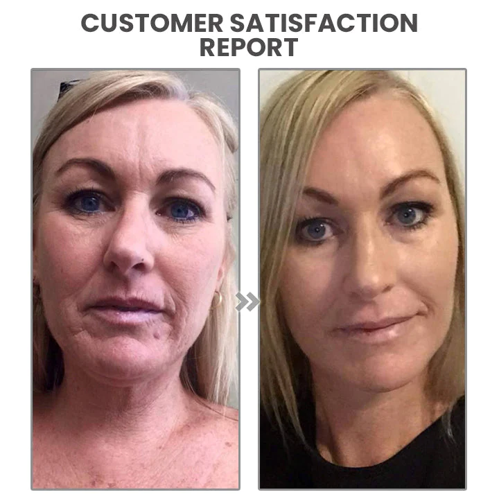 LA LIFT Revitalizing Botox Serum - Image 7