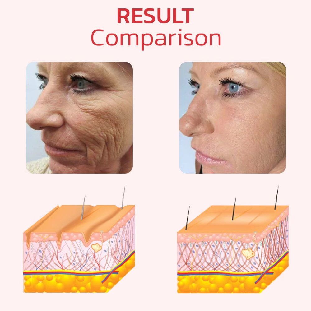 Flysmus™ EggSkin Astaxanthin Collagen Firming Mask - Image 5