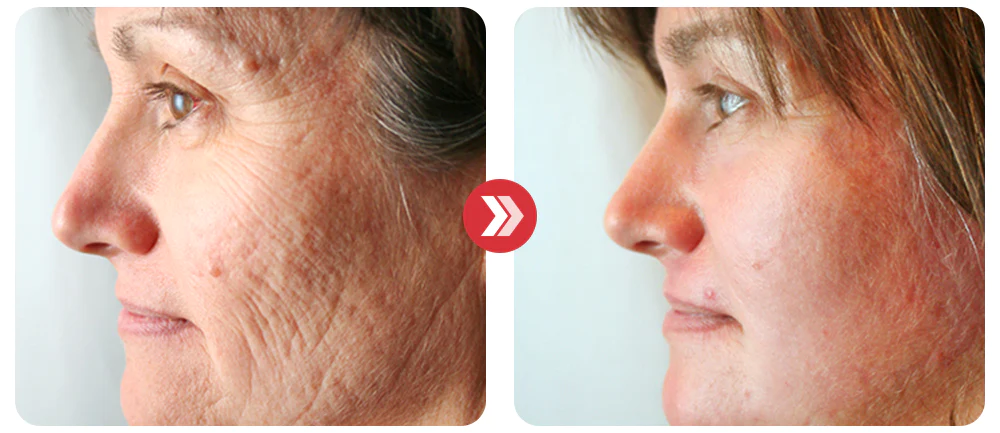 EggSkin Astaxanthin Collagen Firming Mask - Image 6