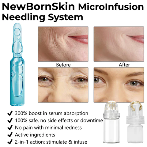 Oveallgo™ NewBornSkin MicroInfusion Needling System - Image 7