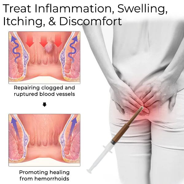 Fivfivgo™ Hemorrhoids Treatment Gel - Image 3