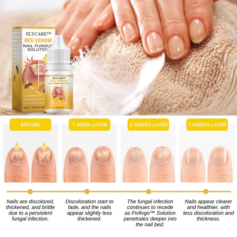 FLYCARE™ BeeVenom Nail Fungus Solution - Image 7