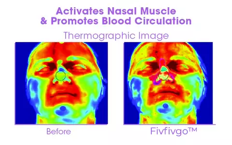 Fivfivgo™ Nose Sculpting Device