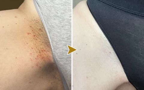 EdiJonah™ Skin Whitening Essence Ampoule - Image 3