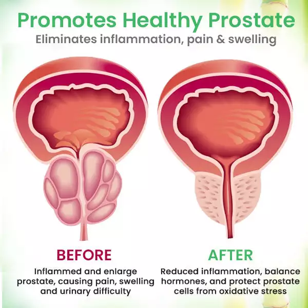 LOVILDS™ Detox Prostate Care Patch