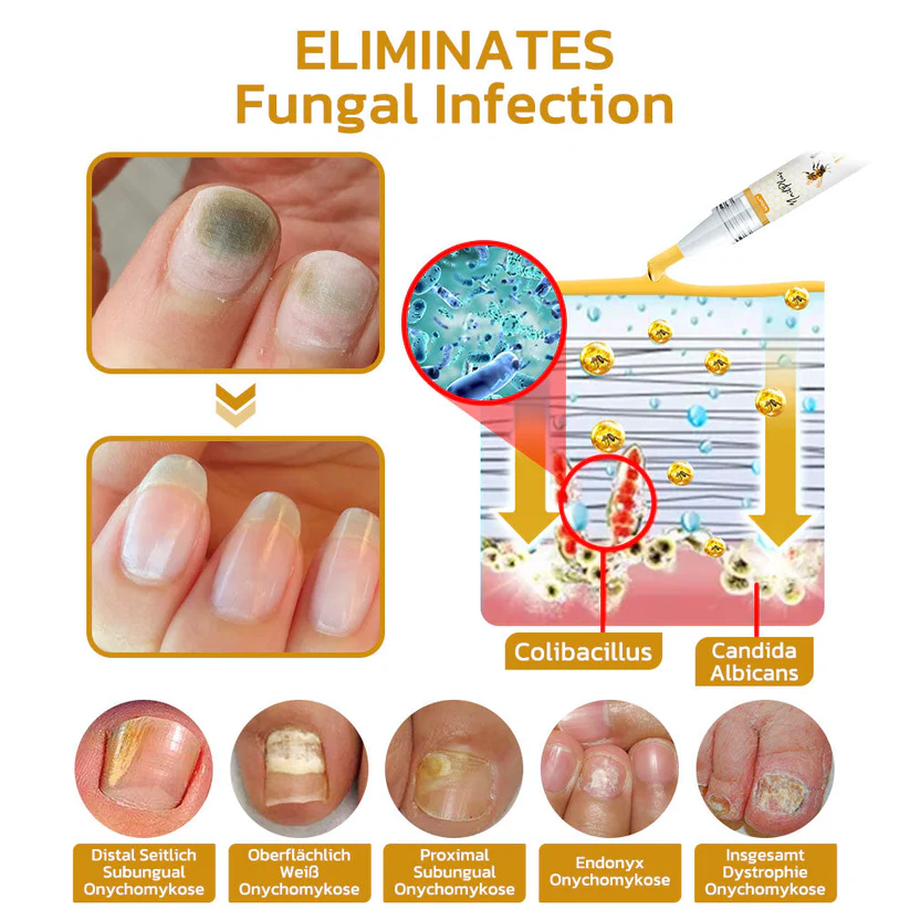 GFOUK™ NailPlus Strong Bee Venom 7 Days Growth Nail Gel - Image 9