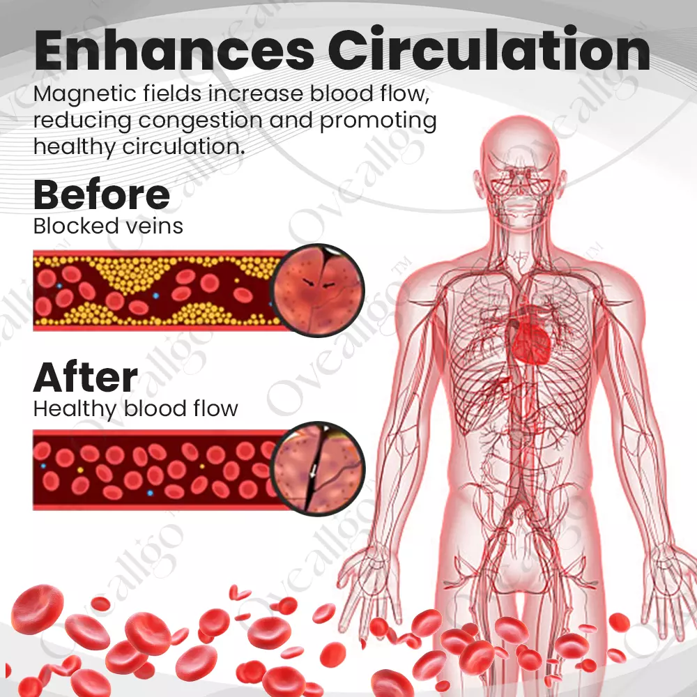 Oveallgo™ PRO CopperMag Prostate Therapy Ring
