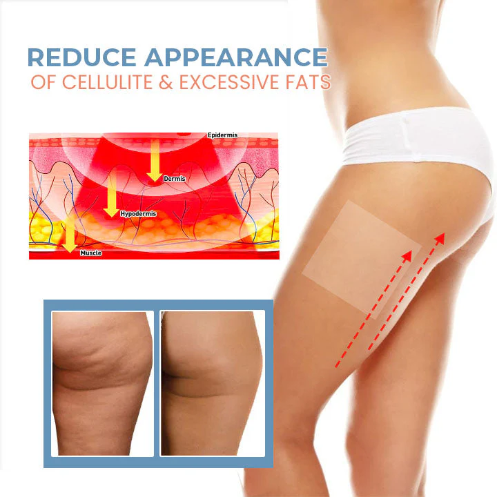 Oveallgo™ Tighten Cell Pro Anti-Cellulite Collagen Firming Patches - Image 4