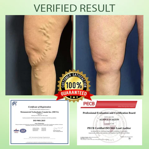 NESLEMY™ Circulation Max Tourmaline Fiber Leg Sleeves - Image 5