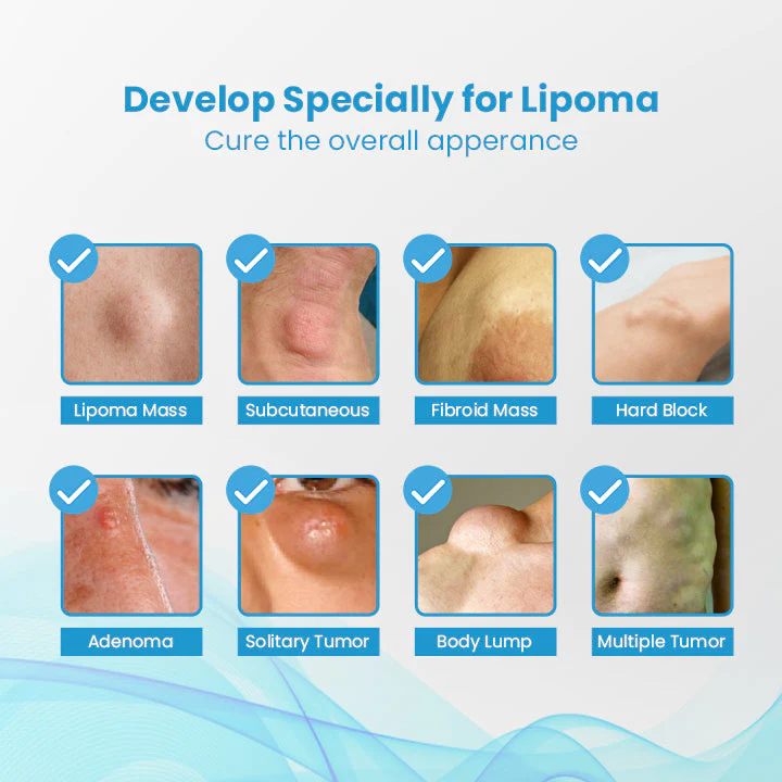 HEALumps™ Lipoma Treatment Ointment - Image 7