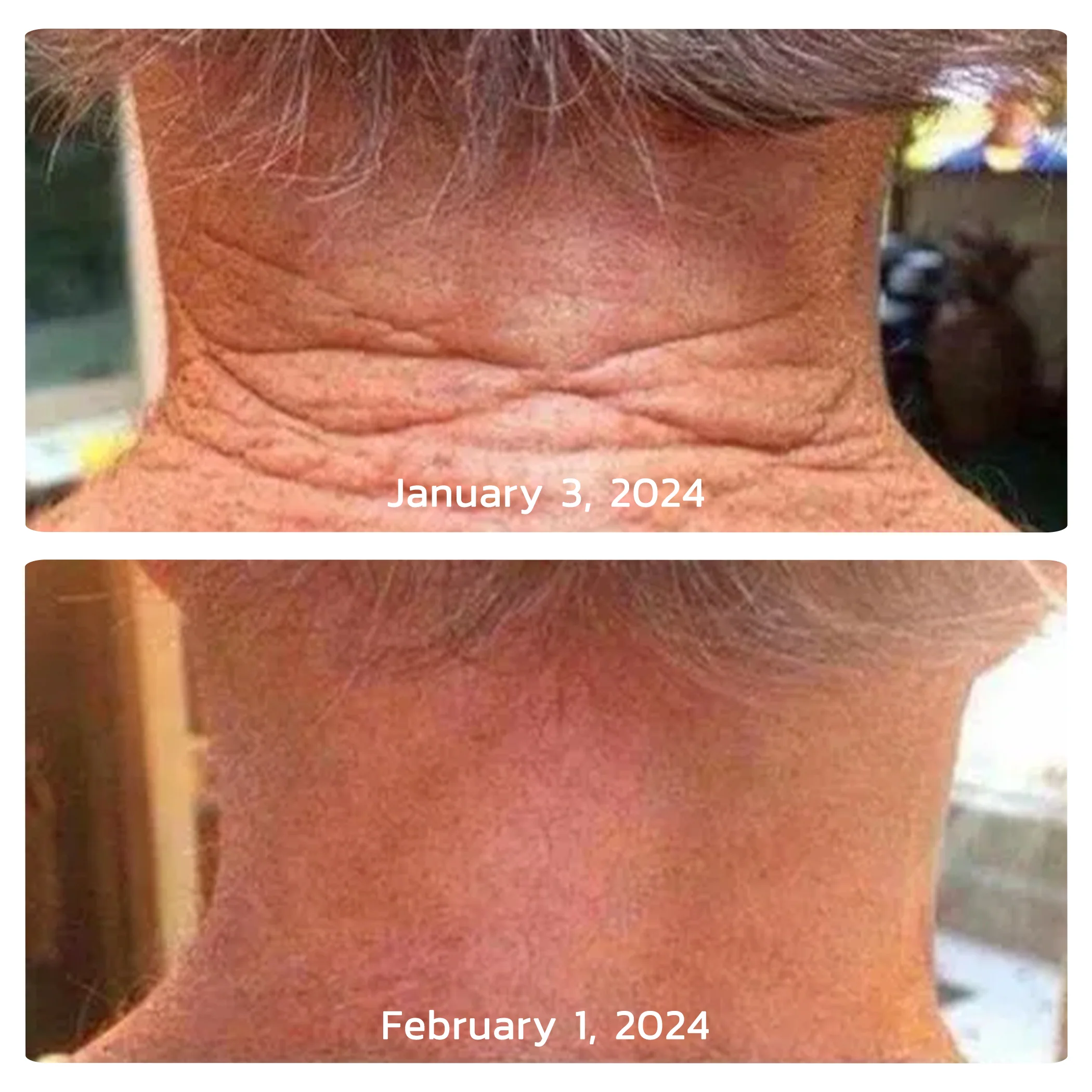 Moondar™ Стягащ и обновяващ крем - Изображение 6