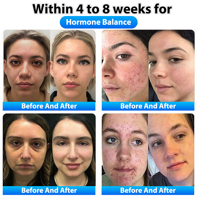 Cvreoz™ NMN የተፈጥሮ የማህፀን ጥገና ካፕሱሎች - ምስል 3