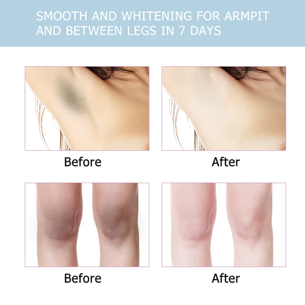 BELLEZON™ Body Care Brightening Cream - Image 4