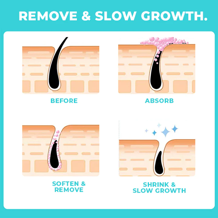 Skinetic™ Peach Fuzz Hair Removal Cream - Image 5