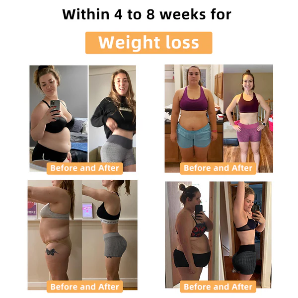 Paiduis™ Ice Silk Ion Fiber Repair Shaping Shorts - Image 3