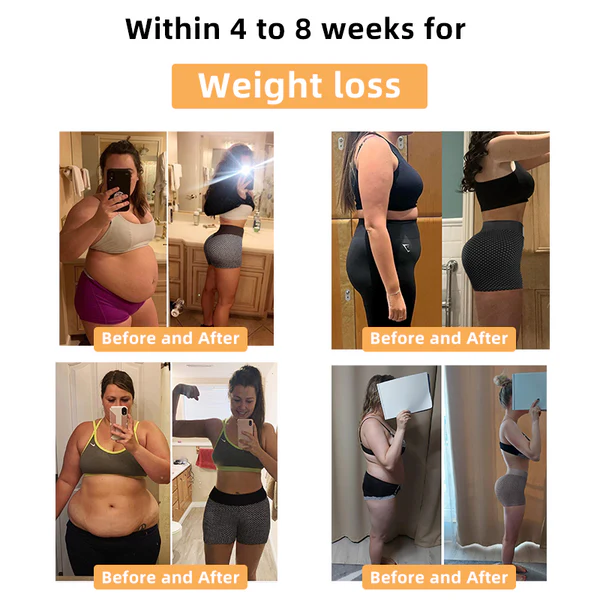 Paiduis™ Ice Silk Ion Fiber Repair Shaping Shorts - Image 4