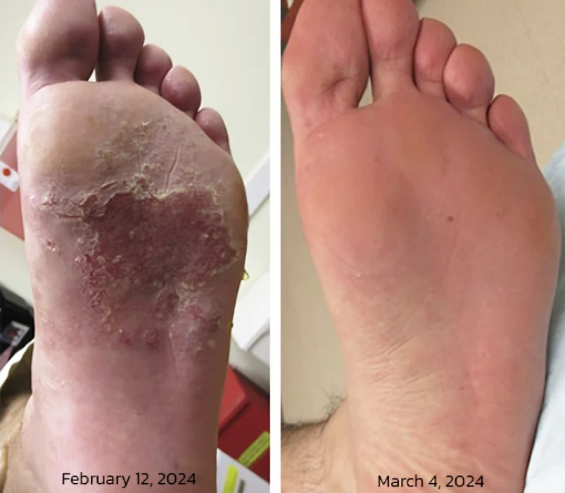 GFOUK™ PediSpa Foot Scrub Spray - Image 2