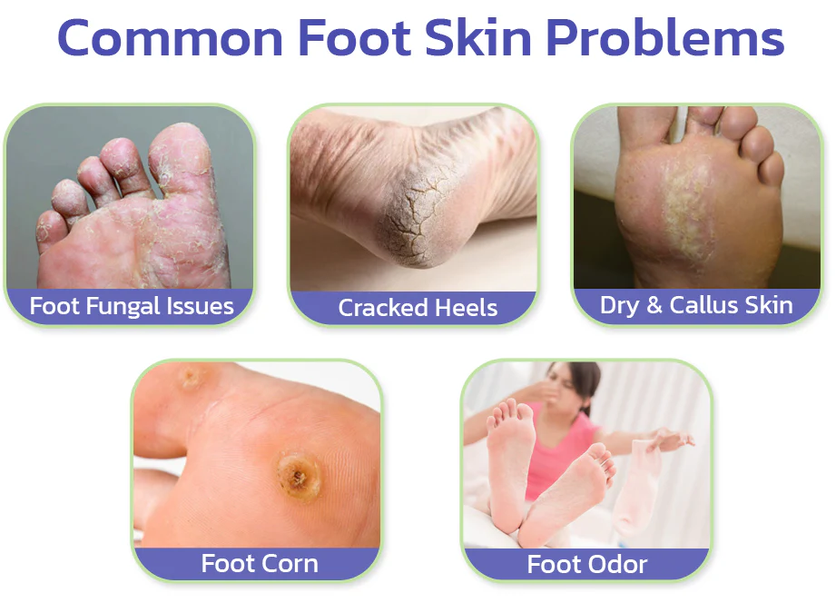 GFOUK™ PediSpa Foot Scrub Spray - Image 5