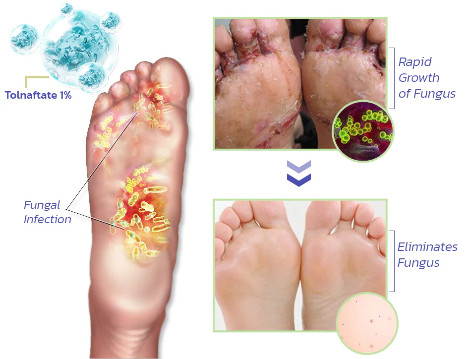 GFOUK™ PediSpa Foot Scrub Spray - Image 6