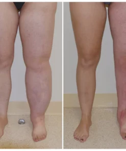 FLYCARE™ Turmeric Arthritis Relief Spray