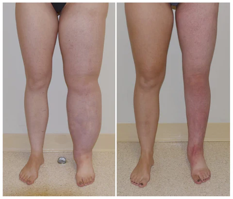 FLYCARE™ Turmeric Arthritis Relief Spray