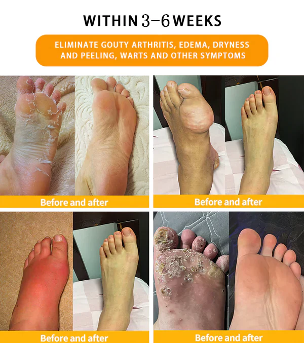 Raindew™ Herbal Body Detox Foot Soak Beads - Image 3