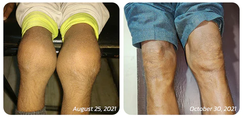 GFOUK™ Letfix Joint And Bone Therapy Spray - Image 7