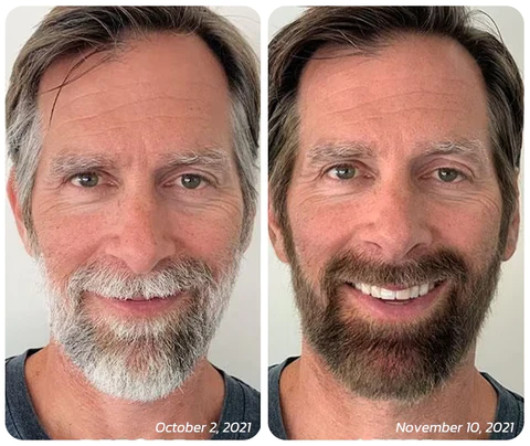 flysmus™ INKAPLUS Anti Greying Hair Serum - Image 6