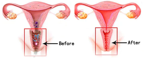 PinkMarine™ Fish Oil Softgel Capsules - Image 6