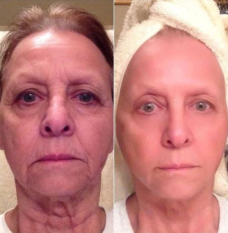 Renetur™ Super Skin Renewing Regenerating Serum - Image 5