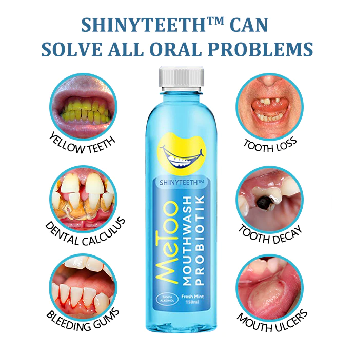 Shinyteeth™ Mouthwash, Calculus Removal, Teeth Whitening, Healing Mouth Ulcers, Eliminating Bad Breath, Preventing and Healing Caries, Tooth Regeneration - Image 5