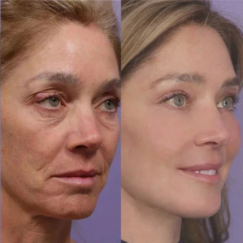 HAK™ Anti-Aging Skincare & Antioxidant Renewal Serum - Image 8