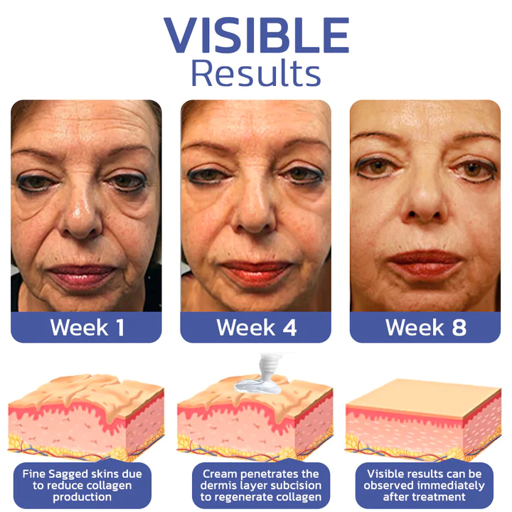 flysmus™ BIGEYES Lifting Eyelid Defining Cream - Image 3