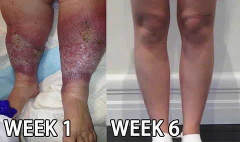 NailREBORN™ Antifungal - Professional Strength - Image 6