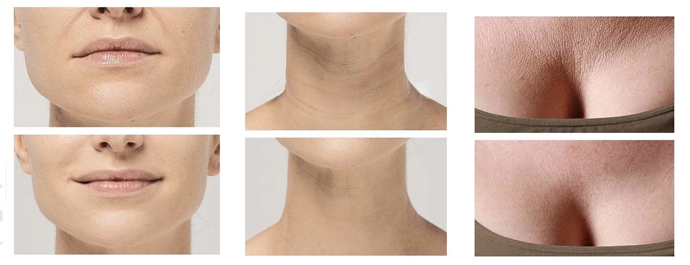 Invisicrepe™ Anti-Wrinkle Face and Body Patches - Image 7