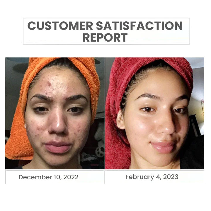 Oveallgo™ Japan Natural Amino Acids Cleansing Foam - Image 5