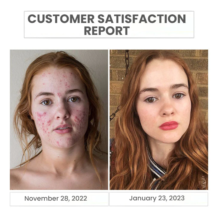 Oveallgo™ Japan Natural Amino Acids Cleansing Foam - Image 4