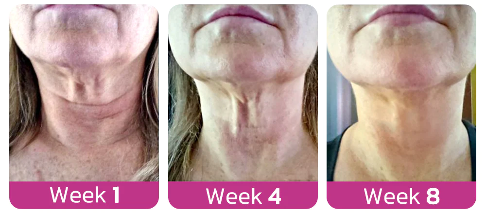 flysmus™ Spain NECKPON Hydrolized Collagen Neck Cream - Image 8